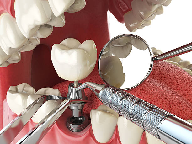 Best Weekend Emergency Dentist in Somers, MT