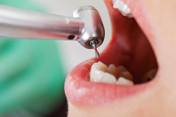 Best Urgent Care for Lost Fillings or Crowns in Somers, MT